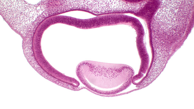 Eye development. Cells from both the mesodermal and the ectodermal tissues contribute to the formation of the eye.  In the center is a crystalline lens.