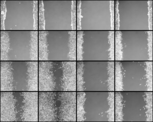 Sequential images of in vitro wound healing (scratch assay) performed on skin cells subjected to...