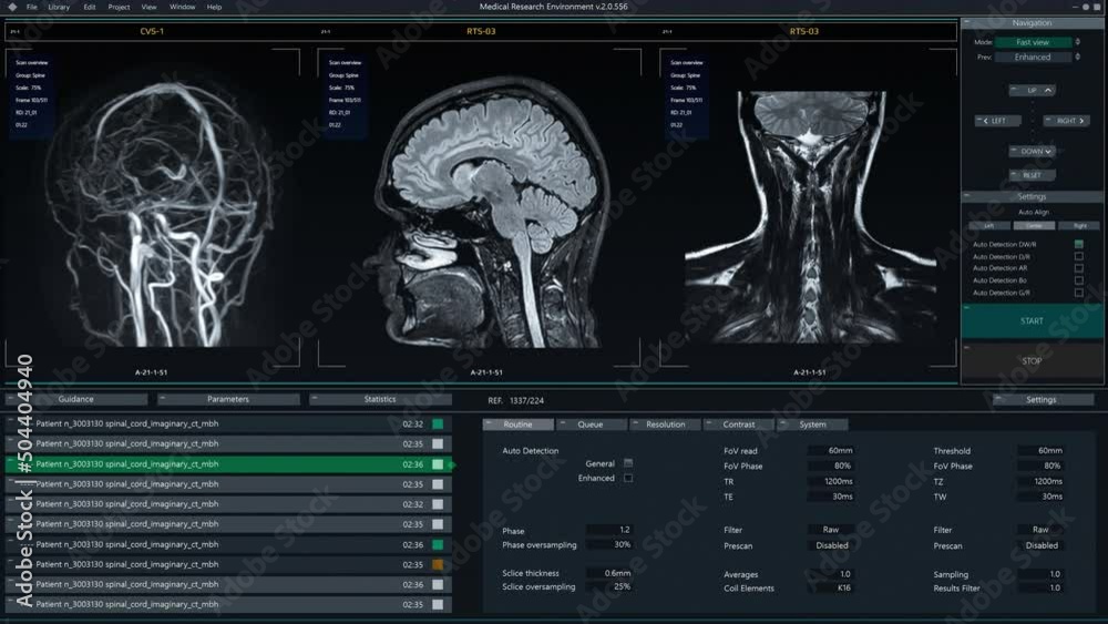 Poster Magnetic Resonance Imaging Brain Scan Mock-up with Multiple Windows and Data. Medical Research Environment Software with MRI Results for Computer Displays and Laptop Screens.