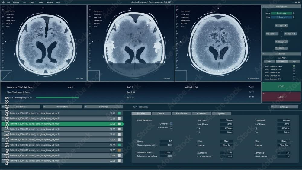 Aufkleber Magnetic Resonance Imaging Brain Scan Mock-up with Multiple Windows and Data. Medical Research Environment Software with MRI Results for Computer Displays and Laptop Screens.