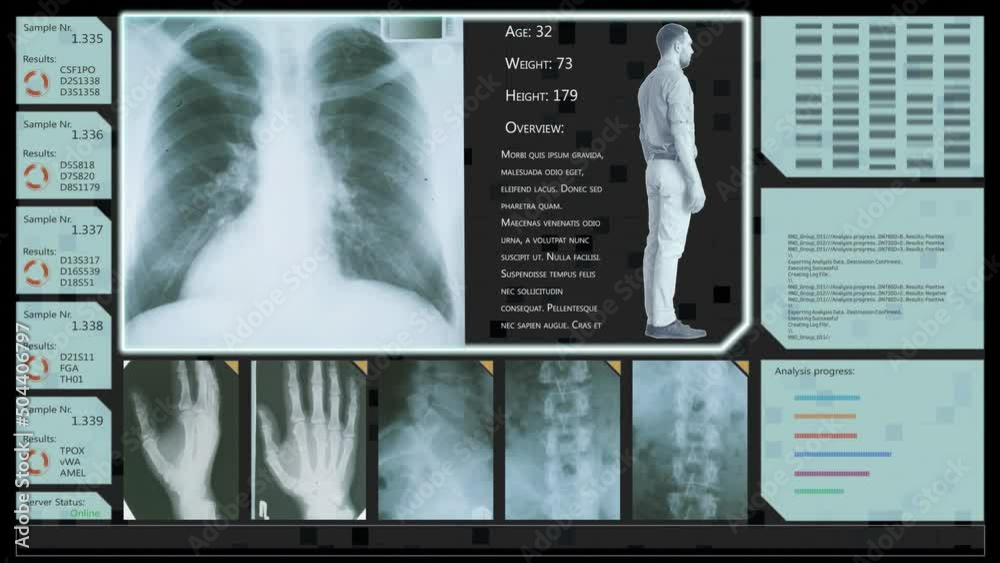 Aufkleber Computed Tomography Chest Scan Mock-up with Multiple Windows and Data. Medical Research Environment Software with CT Scan Results for Computer Displays and Laptop Screens.