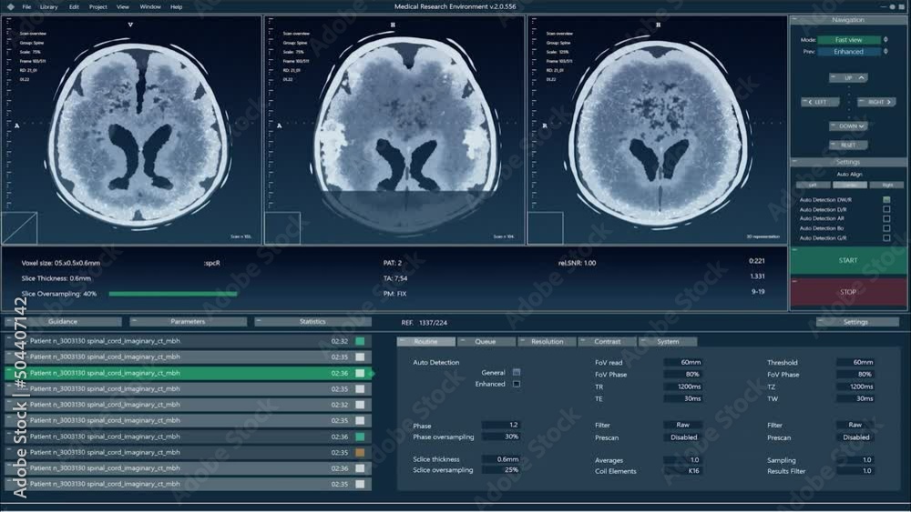 Aufkleber Magnetic Resonance Imaging Brain Scan Mock-up with Multiple Windows and Data. Medical Research Environment Software with MRI Results for Computer Displays and Laptop Screens.
