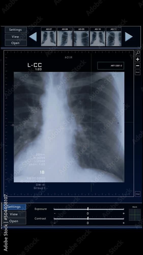 Poster Vertical Screen: Computed Tomography Chest Scan Mock-up with Multiple Windows and Data. Medical Research Environment Software with CT Scan Results for Computer Displays and Laptop Screens.