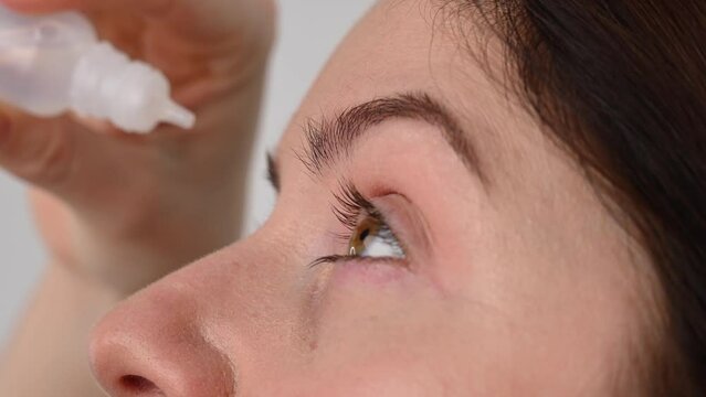 Caucasian woman dripping moisturizing drops into her eyes. 