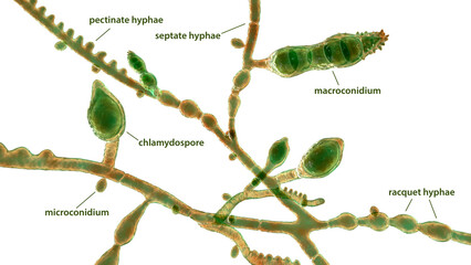 Microscopic fungi Microsporum audouinii, 3D illustration