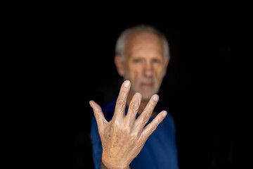 Defocused elderly man showing his right hand with amputated middle finger