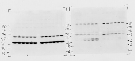 Skan of western blotting film with an image of two membranes subjected to antibodies recognizing different protein species visible as black spots or blots.
