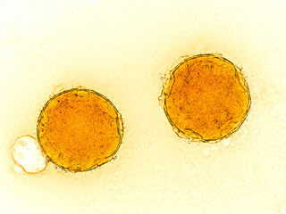 cucurbita pepo pollen grains under the microscope - optical microscope x400 magnification