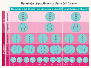 Nondisjunction: Abnormal Germ Cell Division