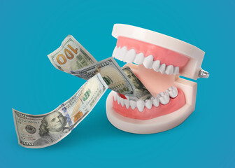 Model of oral cavity with teeth and dollar banknotes on turquoise background. Concept of expensive...