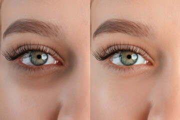 Collage with photos of tired woman with dark circle under eye and after rest, closeup