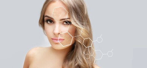 Dark spots, freckles,hyperpigmentation(melasma or chloasma),concept - skin lightening, skin...