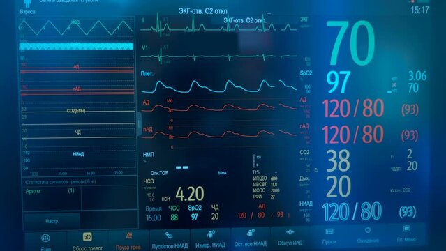 Heart rate monitor screen with live graph and numeric data of heart work. Close up