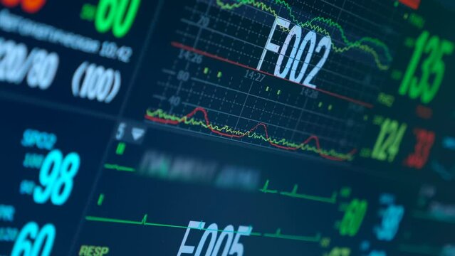 Heart rate monitor screen with live graph and numeric data of heart work. Close up