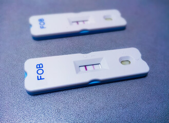 Fecal occult blood test (FOBT) negative by using rapid test cassette, colorectal cancer diagnosis