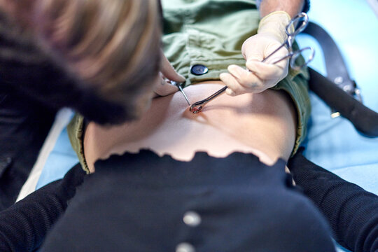Crop piercer using forceps on belly button of woman