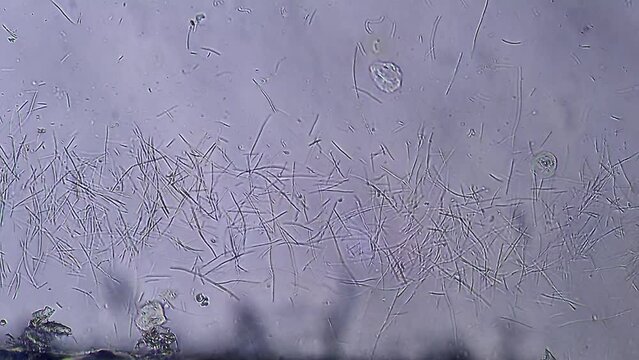 Colony of bacteria, microscope magnification