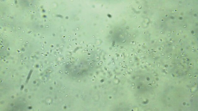 Colony of bacteria, microscope magnification