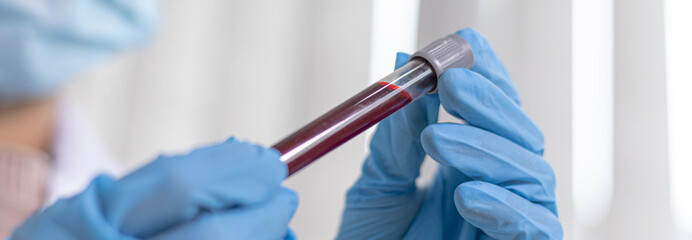 Scientists are testing antiretroviral drugs from the blood of infected patients in order to analyze...