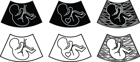 Baby Sonogram Diagram Clipart Set - Outline and Silhouette - obrazy, fototapety, plakaty