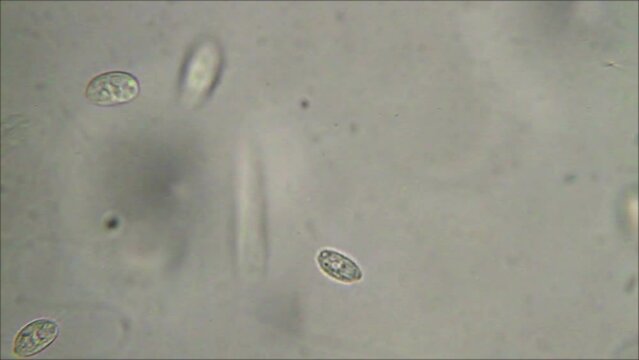 Micro organism ciliate moving