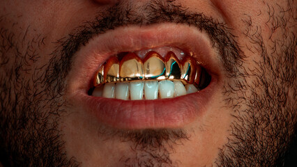 Grillz - Dental Jewelry - obrazy, fototapety, plakaty