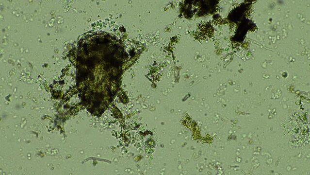 microorganisms and soil biology, with nematodes and fungi under the microscope. in a soil and compost 
