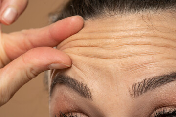 Woman checking her wrinkles on her forehead