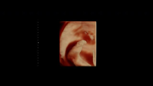 Ultrasonography of Baby in mother's womb. Ultrasound of baby body and spine. Tiny baby is turning in mother's belly. 12 weeks of life. Sonography of pregnant woman