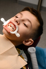 Visit to the orthodontist, installation of braces on the upper teeth, white retractor on the lips...