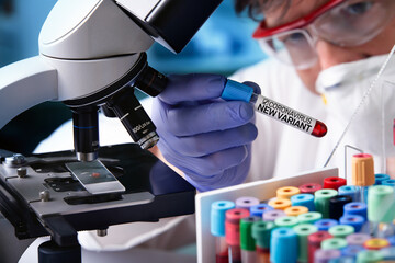 Researcher in analysis lab holding blood sample tube of new Variant of Coronavirus. Scientist...