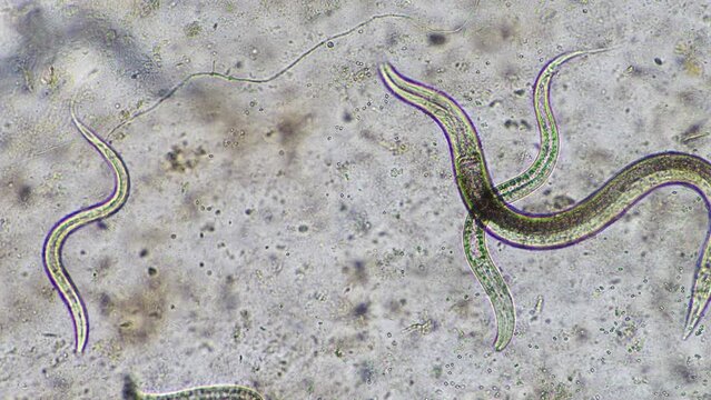nematode in compost, in soil under the microscope	
