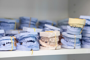 Dental gypsum models cast of a human dental jaw. Gypsum models lie on a shelf in a row. Laboratory prosthetics. Close-up shot. Shelf with lying on her casts of teeth and prosthetic and restorations