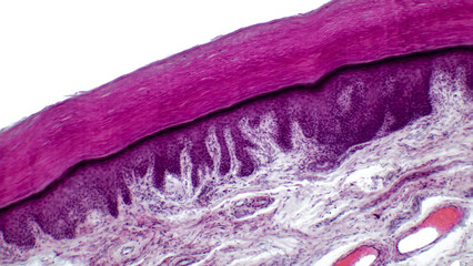 Human skin. Light micrograph of epithelial tissue from the skin. Human finger section showing epidermis (stratified squamous epithelium), dermis and connective tissues.  H&E stain. - obrazy, fototapety, plakaty