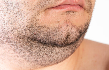 Naklejka premium The face of an overweight man. Fat double chin. Aesthetic defect. double chin correction, close-up