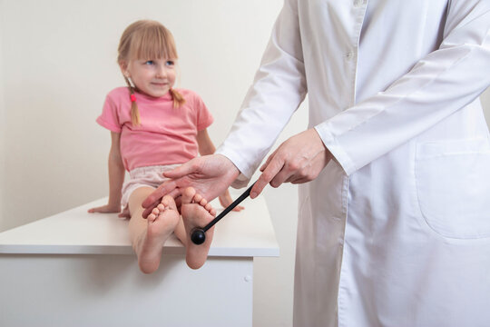 Doctor neuropathologist checks the plantar reflex on the leg of a little girl. Treatment and diagnosis of neurological diseases