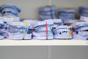Dental gypsum models cast of a human dental jaw. Gypsum models lie on a shelf in a row. Laboratory...