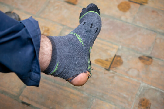 A Hole In The Sock, The Leg Of A Manual Worker