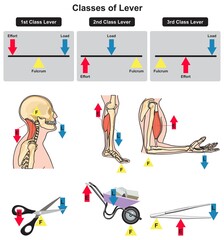 Classes of lever infographic diagram for physics science education example types human body muscles scissors wheelbarrow tongs  parts fulcrum load effort chart cartoon vector drawing illustration  - obrazy, fototapety, plakaty