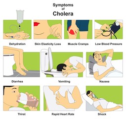 Symptoms of cholera epidemic infectious disease infographic diagram diagnosis signs for medical science education illness cartoon vector drawing chart illustration scheme physical examination test - obrazy, fototapety, plakaty