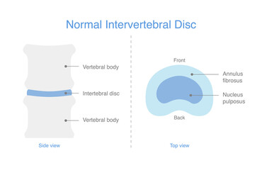 Schematic representations of the normal intervertebral disc. Illustration of medical diagram for the bone spine.