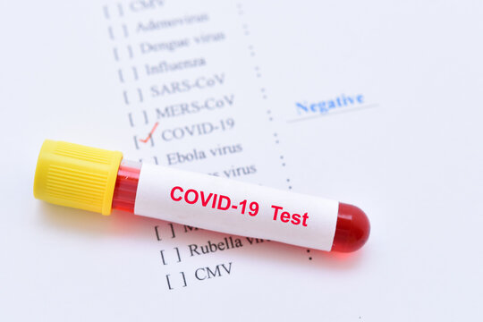 Blood sample tube with COVID-19 negative test result