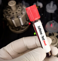Blood sample for Caffeine blood test, drug therapy. A medical testing concept, theophylline test.