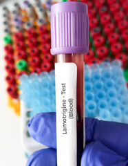 Blood sample for Lamotrigine blood test, monitoring concentration of lamotrigine in blood,...