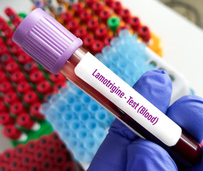 Blood sample for Lamotrigine test(blood), monitoring concentration of lamotrigine in blood,...