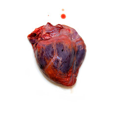 An isolated heart on a white background with symptoms of cardiac suffering next to a drop of blood