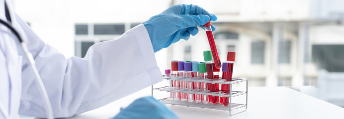 Scientists or physicians analyze the blood sample in vitro to prepare a vaccine against a new...