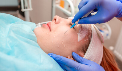 Cosmetology mesotherapy for facial rejuvenation. Mikronidling cosmetic procedure. The beautician...