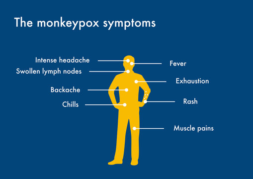 The main symptoms of monkeypox disease