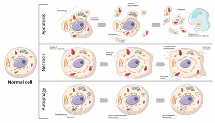 Three basic forms of cell death: apoptosis (chromosome condensation, nuclear fragmentation), autophagy (autophagosome formation), necrosis (membrane rupture, organelles swelling).  - obrazy, fototapety, plakaty